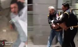 Genç kıza kaynar su döktü, Cani abi gözaltına alındı