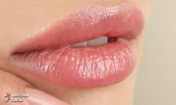 Dudak Dolgusu Nedir? Neden Tercih Edilir?