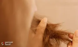 Uzmanından saç dökülmesi uyarısı: Günde 100 tele kadar kayıp normal