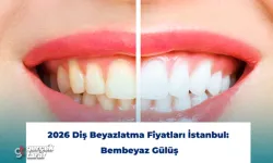 2026 Diş Beyazlatma Fiyatları İstanbul: Bembeyaz Gülüş