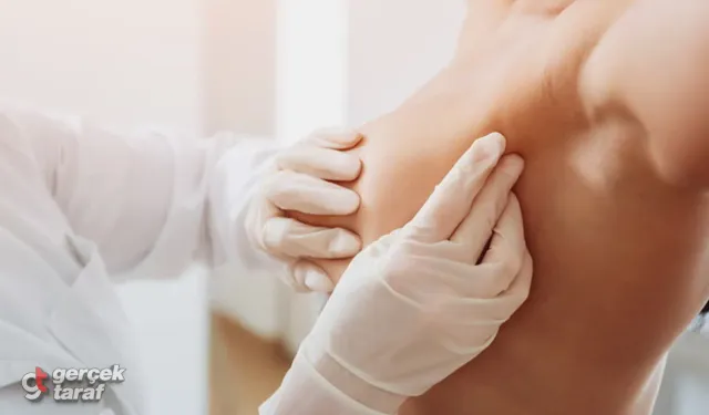 Meme Kanseri Hakkında En Çok Sorulan Sorular ve Yanıtlar