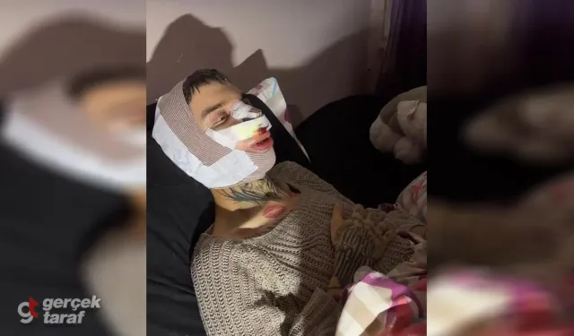 Tablet Reis'ten Zorbalığa Tepki: "Çirkinim Diye Sevilmedim" Dedi, 5 Kez Estetik Oldu