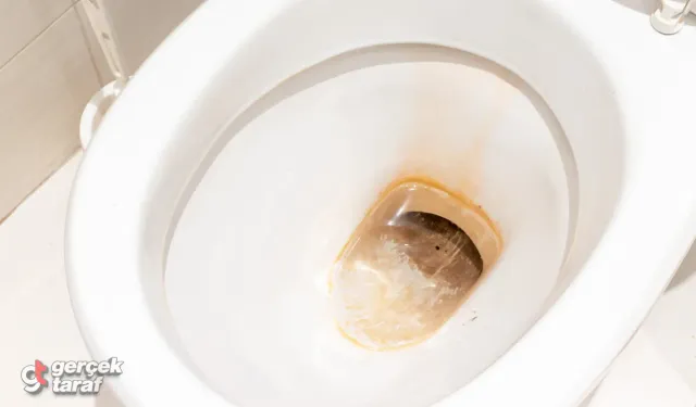 Tuvaletteki Sarı Lekeler Neden Oluşuyor? Sarı Lekeler Dakikalar İçinde Yok Oluyor