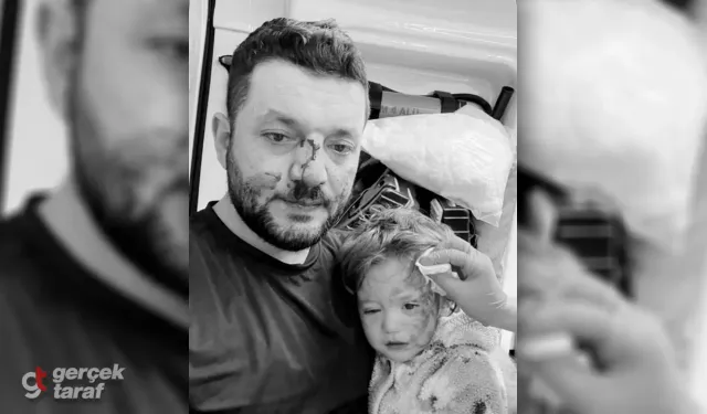 Yalova'da Pide Kuyruğu Dehşeti: Kızını Koruyan Baba Ahmet Baca'nın Burnu, Küçük Kızının Kafatası Kırıldı