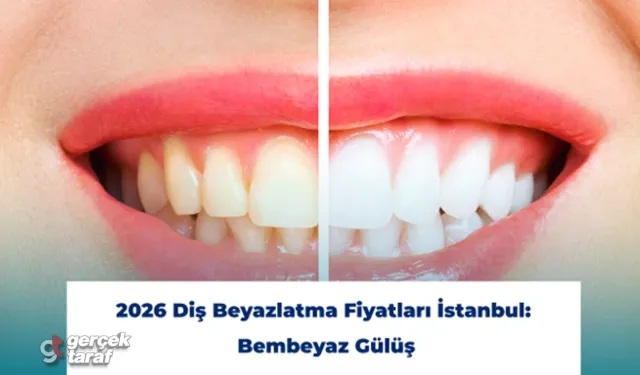 2026 Diş Beyazlatma Fiyatları İstanbul: Bembeyaz Gülüş