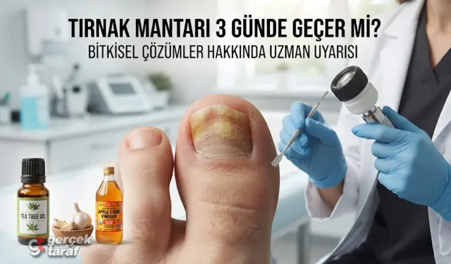Tırnak Mantarı 3 Günde Geçer mi? Bitkisel Çözümler