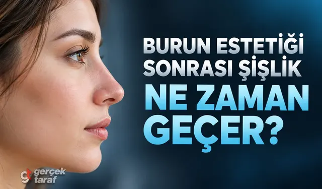 Burun estetiği sonrası şişlik ne zaman geçer?