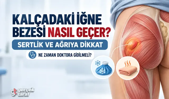Kalçada iğne bezesi nasıl geçer?