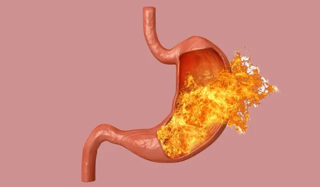Reflü hastaları için Ramazan ayında sağlıklı beslenme önerileri nelerdir?