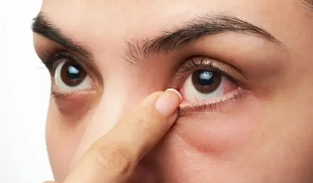 Kış Ayında Hangi Göz Sorunları Olur? Nelere Dikkat Edilmeli?