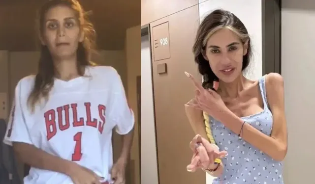 İrem Derici’den Yürek Yakan Paylaşım: “Nihal Candan Gitti İşte, Anlayamadınız”