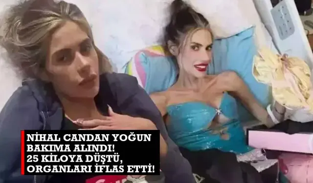 Nihal Candan Yoğun Bakıma Alındı! 25 Kiloya Düştü, Organları İflas Etti!