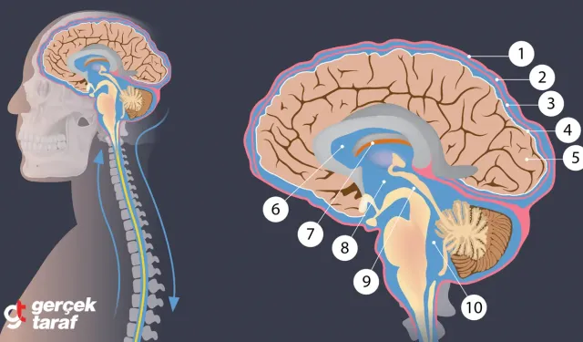Beyinde su birikmesi!