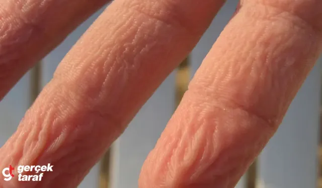 Parmaklar Suda Neden Kırışır, Buruşur?