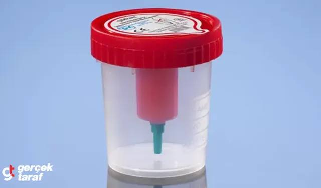 İdrar Kabı Kullanılırken Dikkat Edilmesi Gerekenler