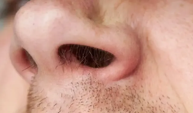 Burun Kıllarını Koparmak Menenjit Riskini Artırıyor!