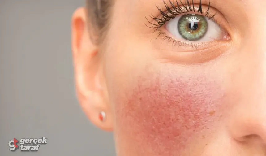 Soğuklarda cilt kuruluğuna karşı 10 tavsiye