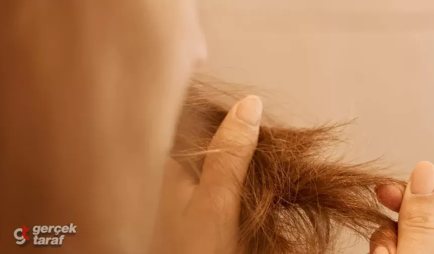 Uzmanından saç dökülmesi uyarısı: Günde 100 tele kadar kayıp normal