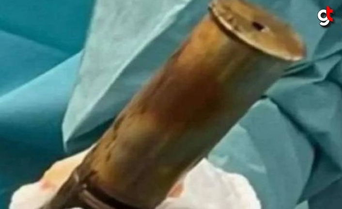 Anüsünden top mermisi çıktı, hastane patlama riskine karşı boşaltıldı